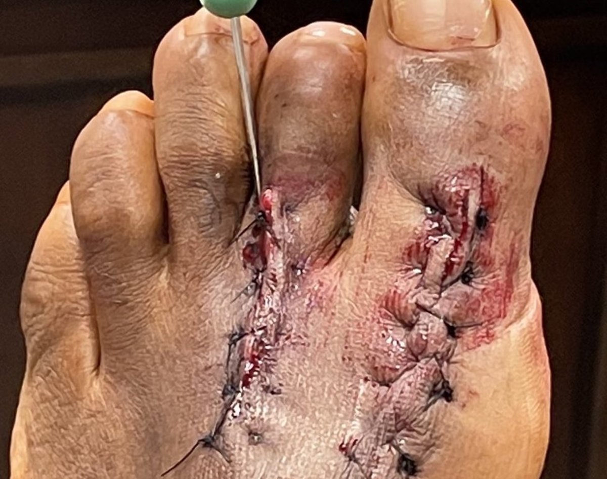 deion foot